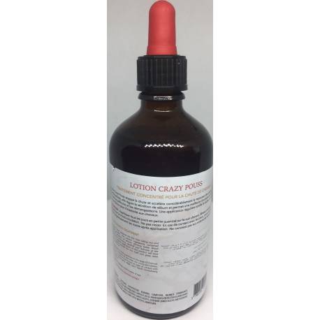 Crazy pouss Hair regrowth treatment...