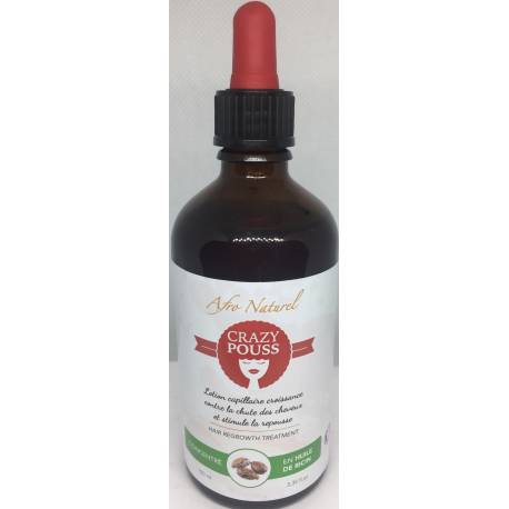 Crazy pouss Hair regrowth treatment...